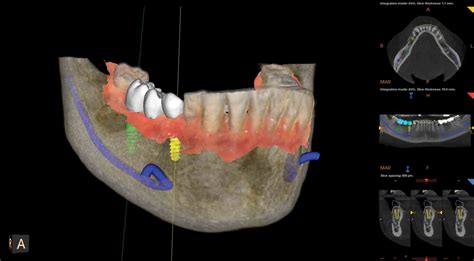 Cbct And Panoramic X Ray Salloum Dental Clinic