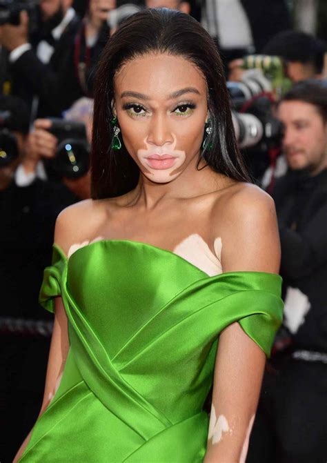 Americas Next Top Models Winnie Harlow Defends Comments On Show