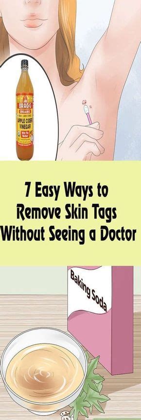 7 easy ways to remove skin tags without seeing a doctor skin tag removal skin tag skin care