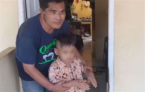Miris Di Bogor Anak 8 Tahun Disiksa Ayah Tiri