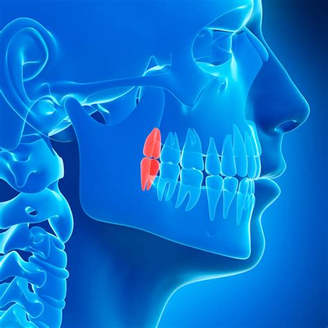 Wisdom Teeth Removal Surgery Benefits Rockwall Oral Surgery