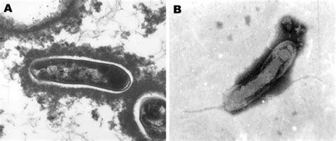 Figure Isolation Of Candidatus Bartonella Melophagi From Human Blood