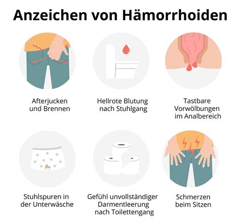 Was sind Anzeichen für Hämorrhoiden