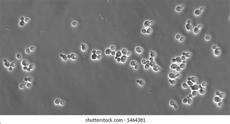 1503 Yeast Cell Microscope Images Stock Photos And Vectors Shutterstock