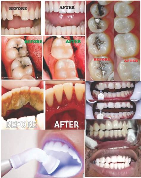 Dental Treatment Dentagama