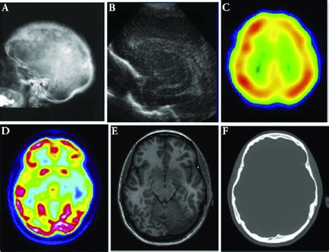 Overview Of The Human Brain Obtained With Different Medical Imaging