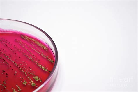 Escherichia Coli Bacteria On Blood Agar Photograph By Choksawatdikorn
