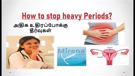Mirena Treatment For Heavy Menstrual Periods அதிக உதிரப்போக்கு