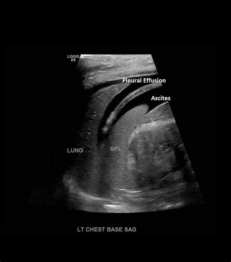 pin by jayne on sonography medical ultrasound diagnostic medical sonography ultrasound