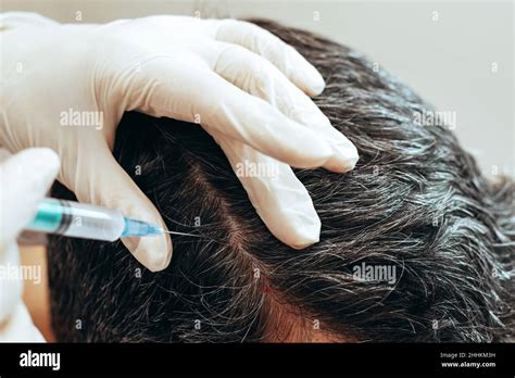 Cosmetologist Performs Anti Aging Procedures Injections Hyaluronic Acid