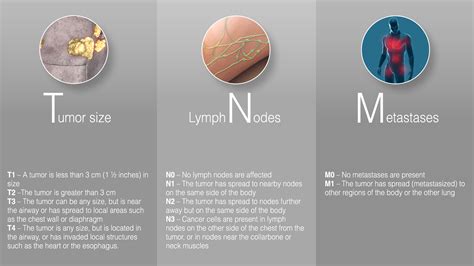 If a tumor has spread from the breast to a sentinel lymph node (if the cancer is lymph node positive) it has essentially declared its intent to spread beyond the breast. Stage 3 Lung Cancer : All that you need to know ...