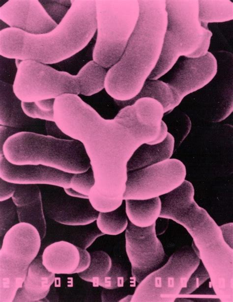Bifidobacterium Strain Helps Reduce Colds Professionals