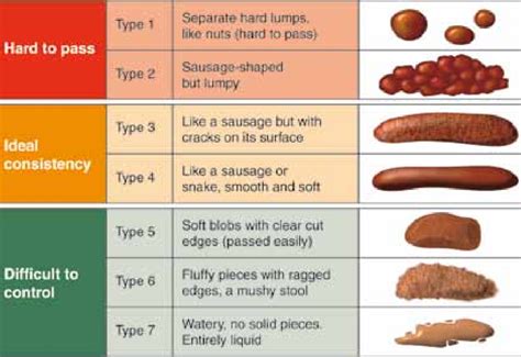 Bristol Stool Form Scale Download Scientific Diagram