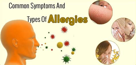 Some Common Symptoms And Types Of Allergies Allergies Symptoms Type