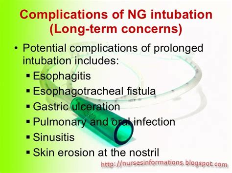 Nasogastric Tube Ngt Insertion And Removal