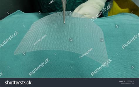 Synthetic Mesh Used Surgical Repair Hernia Stock Photo 1277324170