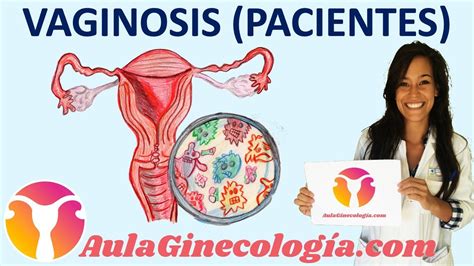 Vaginosis Bacteriana Pacientes S Ntomas Causas Tratamiento Reca Da Ginecolog A Y