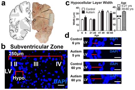 Cellular Organization In The Human Subventricular Zone Of The Lateral