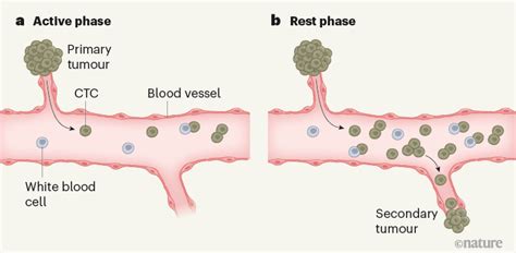 Cancer Cells Spread Aggressively During Sleep