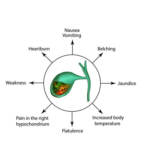 Gallbladder Pain Location Diagram