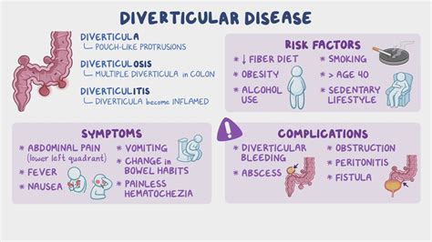 Diverticular Disease Nursing Osmosis Video Library