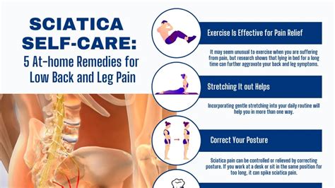 Managing Sciatica Understanding Causes Symptoms And Treatment Options
