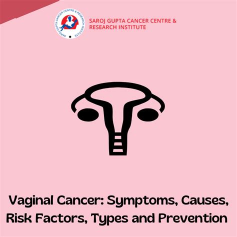 Vaginal Cancer Symptoms Causes Types Prevention