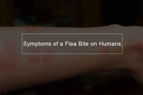 What Does A Flea Bite Look Like Stopyourskinproblem Com