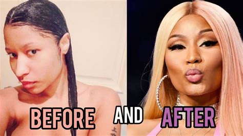 Nicki Minaj Before After Transformation Plastic Surgery Makeup