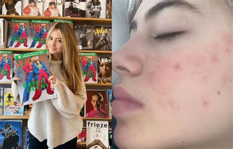 Find leni klum stock photos in hd and millions of other editorial images in the shutterstock collection. Leni Klum modella con l'acne: la frase da pelle d'oca di ...