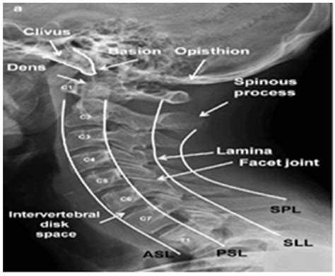 Diagnostics Free Full Text Classification Of Cervical Spine