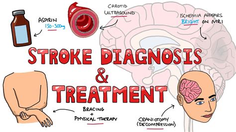 Stroke Diagnosis And Treatment Acute And Long Term Treatment Of