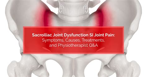 Sacroiliac Joint Dysfunction Si Joint Pain Symptoms Causes