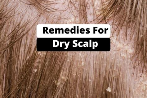 Home Remedies For Dry Scalp Go Lifestyle Wiki