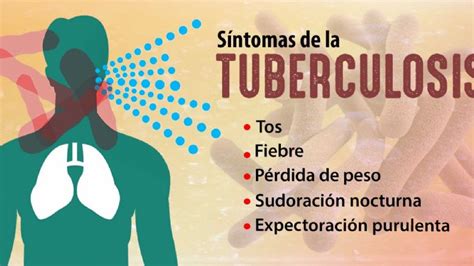 Tuberculosis Una Enfermedad Curable Catamarca Actual