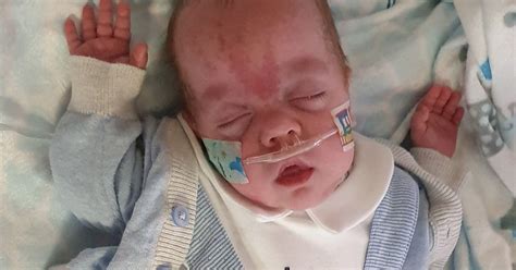 Baby Boy Born Weighing Less Than Than Bag Of Sugar Finally Home After