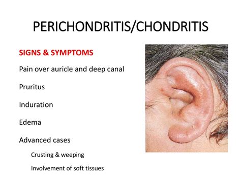 Diseases Of External Ear 1