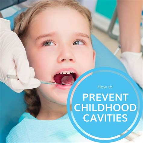 How To Prevent Childhood Cavities Potomac Pediatric Dentistry