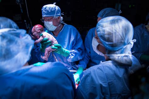 Woman With Transplanted Uterus Gives Birth The First In The U S The New York Times