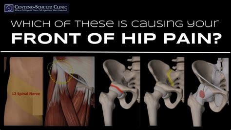 Possible Causes For Pain At The Front Of The Hip Stem Cell Blog