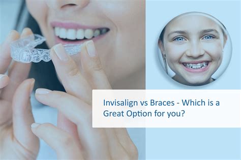 Invisalign vs Braces - Which is a Great Option for you?