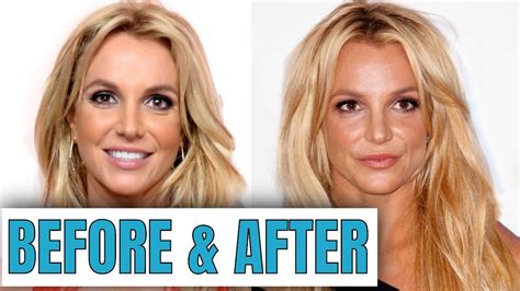 Britney Spears Plastic Surgery Youtube