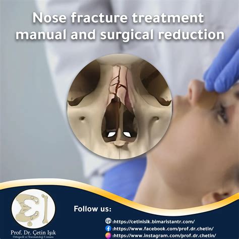 Fractures and trauma surgery - Dr. What's wrong with you?