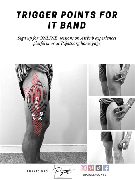 It Band Trigger Points Trigger Point Therapy Trigger Points It Band