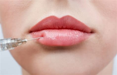 Botox And Fillers In Houston Tx Millennium Physicians