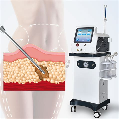 980 1470nm Diode Laser Machine Liposuction Laser Machine 980class Iv