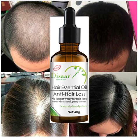 Groveda fast hair growth product for women with peppermint, amla, coconut oil 8.0 7.5 8.1 8: Disaar Fast Powerful Hair Growth Essence Products ...