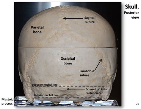 Skull Posterior View With Labels Axial Skeleton Visual Flickr