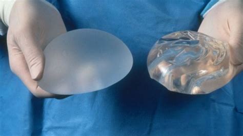 Safer Silicon Breast Implants Made With Bioengineered Silk Coating