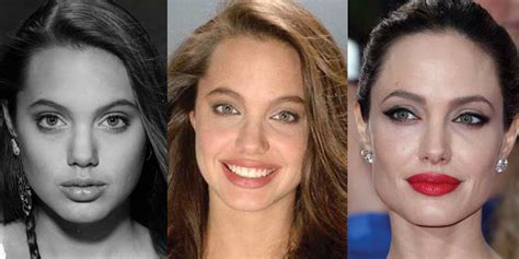 Angelina Jolie Plastic Surgery Before And After Pictures